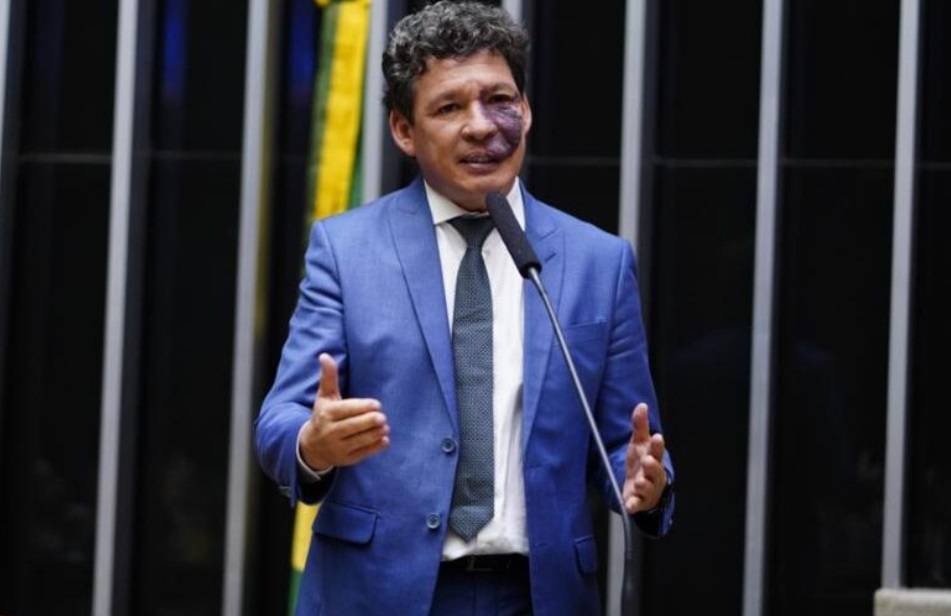 Reginaldo Lopes, deputado federal pelo PT de Minas Gerais (Foto: Pablo Valadares/Câmara dos Deputados)