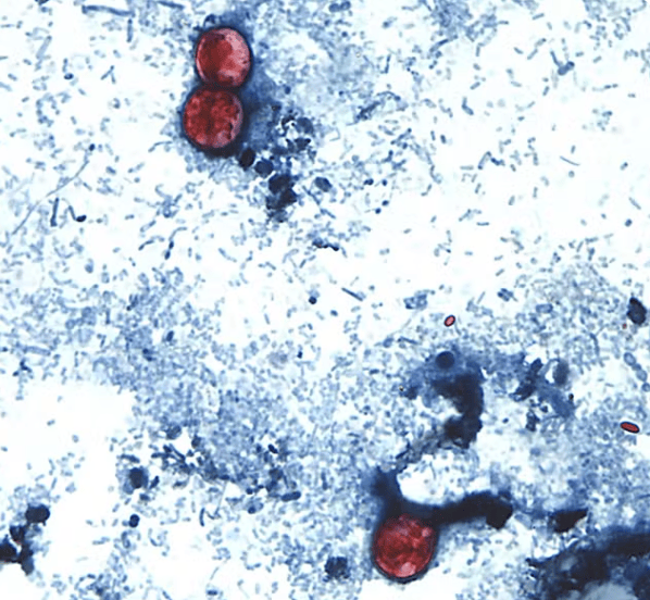 Bactéria que causa diarreia explosiva pode ter contaminado verduras nos EUA
